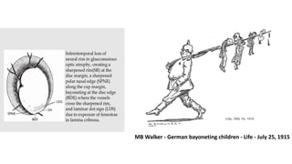 MB Walker - German bayoneting children - Life - July 25, 1915
 