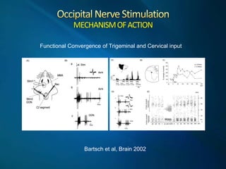 MECHANISM  OF  ACTION  
       
Functional Convergence of Trigeminal and Cervical input
     




                 Bartsch...