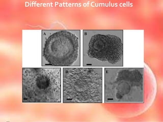 Different Patterns of Cumulus cells
 