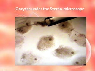 Oocytes under the Stereo-microscope
 