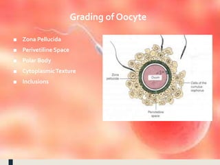 Grading of Oocyte
■ Zona Pellucida
■ Perivetiline Space
■ Polar Body
■ CytoplasmicTexture
■ Inclusions
 