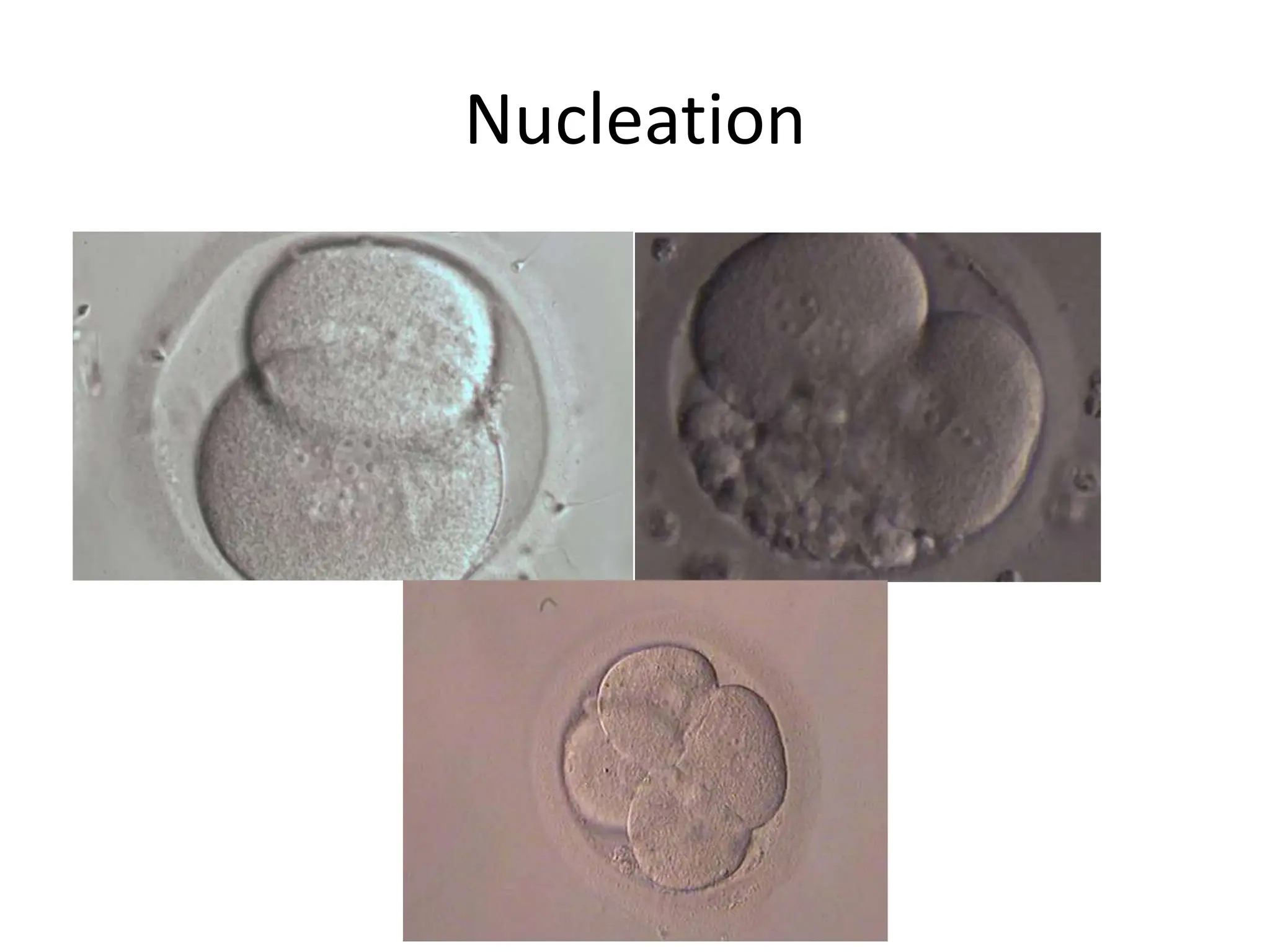Oocyte and Embryo Grading blastocyst grading.pptx