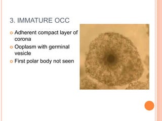 Oocyte grading.pptx... dhsvsusvshshhshsh | PPTX