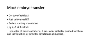 Mock embryo transfer
• On day of retrieval
• Just before real ET
• Before starting stimulation
• eg 4+3 at 3 oclock
shoulder of outer catheter at 4 cm, inner catheter pushed for 3 cm
and introduction of catheter direction is at 3 oclock.
 