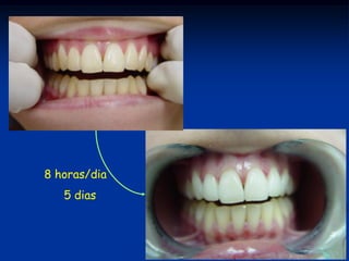 8 horas/dia
   5 dias
 