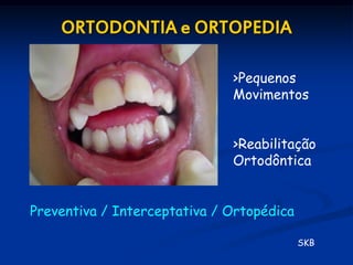 ORTODONTIA e ORTOPEDIA

                              >Pequenos
                              Movimentos


                              >Reabilitação
                              Ortodôntica


Preventiva / Interceptativa / Ortopédica

                                           SKB
 