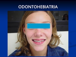 ODONTOHEBIATRIA




                  SKB
 