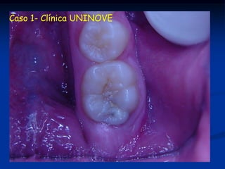 Caso 1- Clínica UNINOVE
 