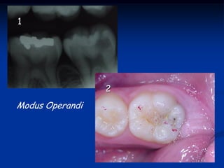 1




                 2
Modus Operandi
 