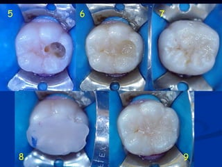 5       6   7




    8           9
 