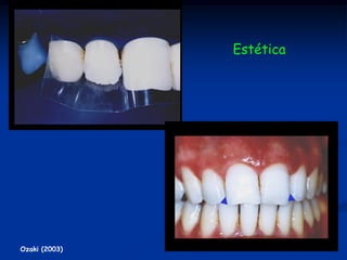 Estética




Ozaki (2003)
 