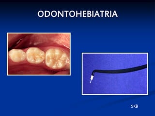 ODONTOHEBIATRIA




                  SKB
 