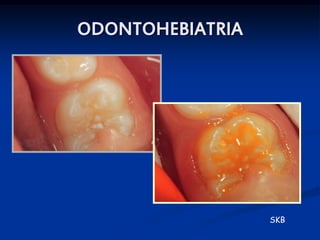 ODONTOHEBIATRIA




                  SKB
 