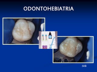 ODONTOHEBIATRIA




                  SKB
 