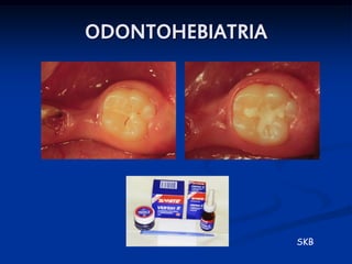 ODONTOHEBIATRIA




                  SKB
 