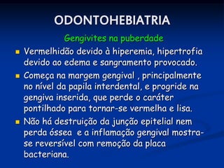 ODONTOHEBIATRIA
              Gengivites na puberdade
   Vermelhidão devido à hiperemia, hipertrofia
    devido ao edema e sangramento provocado.
   Começa na margem gengival , principalmente
    no nível da papila interdental, e progride na
    gengiva inserida, que perde o caráter
    pontilhado para tornar-se vermelha e lisa.
   Não há destruição da junção epitelial nem
    perda óssea e a inflamação gengival mostra-
    se reversível com remoção da placa
    bacteriana.
 