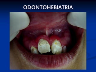 ODONTOHEBIATRIA




                  SKB
 