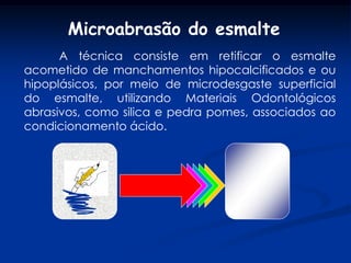 Microabrasão do esmalte
      A técnica consiste em retificar o esmalte
acometido de manchamentos hipocalcificados e ou
hipoplásicos, por meio de microdesgaste superficial
do esmalte, utilizando Materiais Odontológicos
abrasivos, como silica e pedra pomes, associados ao
condicionamento ácido.
 