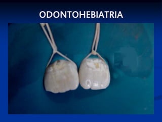 ODONTOHEBIATRIA




                  SKB
 