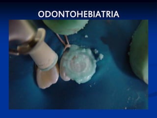 ODONTOHEBIATRIA




                  SKB
 