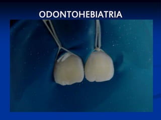 ODONTOHEBIATRIA




                  SKB
 