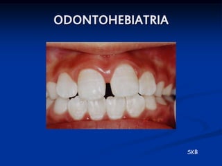 ODONTOHEBIATRIA




                  SKB
 