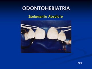ODONTOHEBIATRIA
 Isolamento Absoluto




                       SKB
 