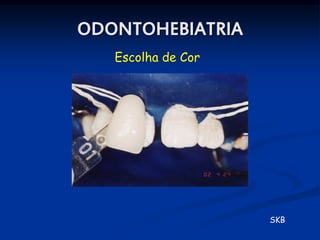 ODONTOHEBIATRIA
   Escolha de Cor




                    SKB
 