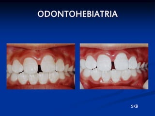 ODONTOHEBIATRIA




                  SKB
 