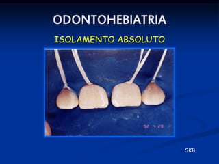ODONTOHEBIATRIA
ISOLAMENTO ABSOLUTO




                      SKB
 