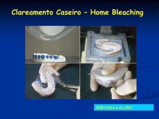 Clareamento Caseiro – Home Bleaching




                      MIRANDA et al.,2002
 