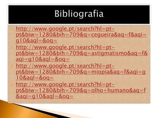    http://www.google.pt/search?hl=pt-
    pt&biw=1280&bih=709&q=cegueira&aq=f&aqi=
    g10&aql=&oq=
   http://www.google.pt/search?hl=pt-
    pt&biw=1280&bih=709&q=astigmatismo&aq=f&
    aqi=g10&aql=&oq=
   http://www.google.pt/search?hl=pt-
    pt&biw=1280&bih=709&q=miopia&aq=f&aqi=g
    10&aql=&oq=
   http://www.google.pt/search?hl=pt-
    pt&biw=1280&bih=709&q=olho+humano&aq=f
    &aqi=g10&aql=&oq=
 