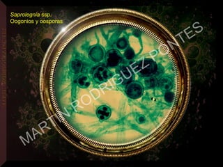Saprolegnia ssp.
Oogonios y oosporas
MARTIN
RODRIGUEZ PONTES
 