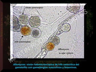 Allomyces: visión fotomicroscópica de hifa cenocítica del
gametofito con gametangios masculinos y femeninos.
MARTIN
RODRIGUEZ PONTES
 