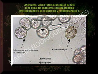 Allomyces: visión fotomicroscópica de hifa
cenocítica del esporofito con esporangios
(meiosporangios de resistencia y mitosporangios´).
MARTIN
RODRIGUEZ PONTES
 
