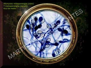 Allomyces: mitosporangios (claro)
Y meiosporangios (oscuro).
Azul de metilo.
MARTIN
RODRIGUEZ PONTES
 