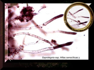 Saprolegnia ssp..Hifas cenocíticas y
zoosporangios terminalesMARTIN
RODRIGUEZ PONTES
 
