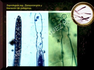 Saprolegnia ssp. Zoosporangios y
liberación de zoósporas
MARTIN
RODRIGUEZ PONTES
 