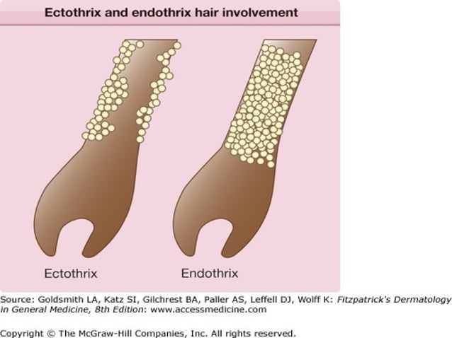fungal infection of skin ppt | PPT | Foot Health | Diseases and Conditions