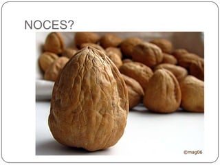 NOCES?<br />