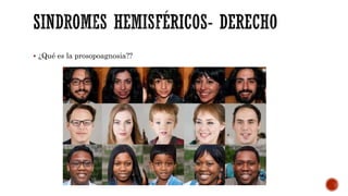  ¿Qué es la prosopoagnosia??
 