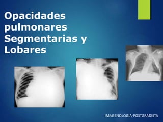 Opacidades
pulmonares
Segmentarias y
Lobares
IMAGENOLOGIA-POSTGRADISTA
 
