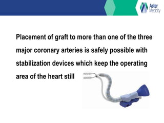 Placement of graft to more than one of the three
major coronary arteries is safely possible with
stabilization devices which keep the operating
area of the heart still
 