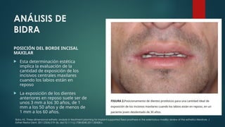 Labio Reposo OPCIONES PROTÉSICAS EN PACIENTES EDÉNTULOS (5) con bibliografias.pptx