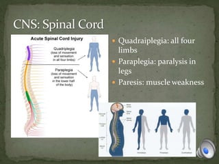  Quadraiplegia: all four
limbs
 Paraplegia: paralysis in
legs
 Paresis: muscle weakness
 