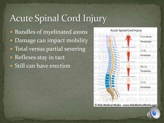  Bundles of myelinated axons
 Damage can impact mobility
 Total versus partial severing
 Reflexes stay in tact
 Still can have erection
 