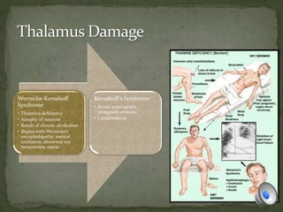 Wernicke-Korsakoff
Syndrome
• Thiamine deficiency
• Atrophy of neurons
• Result of chronic alcoholism
• Begins with Wernicke’s
encephalopathy: mental
confusion, abnormal eye
movements, ataxia
Korsakoff’s Syndrome
• Severe anterograde,
retrograde amnesia
• Confabulation
 