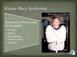 Removal or Destruction
of Amygdala
• Placidity
• Apathy
• Hyperphagia
• Hypersexuality
• Agnosias
 