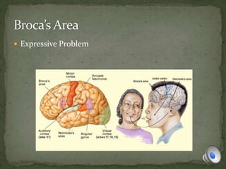  Expressive Problem
 