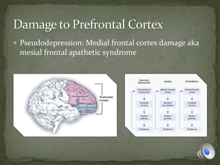  Pseudodepression: Medial frontal cortex damage aka
mesial frontal apathetic syndrome
 